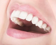 重庆牙科医院牙齿美白收费标准，3D锆齿美白才100+