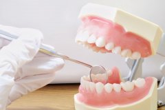 郑州牙科医院补牙价目表，日本玻璃离子补牙200元+太实惠 