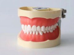 石家庄牙科医院贴面价格表，石家庄做贴面好的口腔医院展示